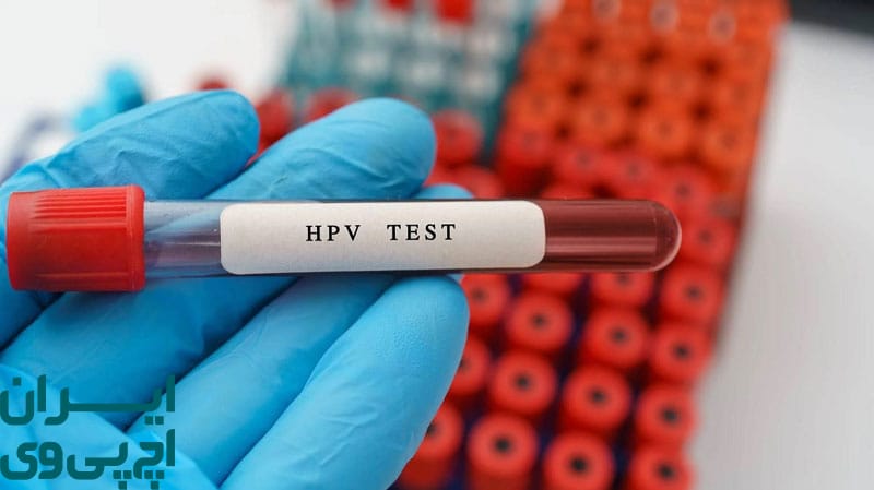 اهمیت انجام تست HPV DNA در تشخیص خروج ویروس