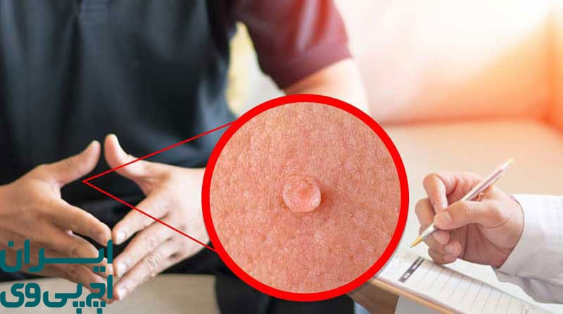 اهمیت پایبندی به روش‌ های پیشگیری HPV در روابط جنسی