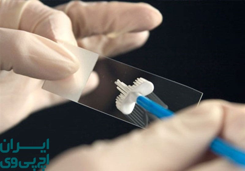 ترکیب پاپ اسمیر و تست HPV برای افزایش دقت تشخیص