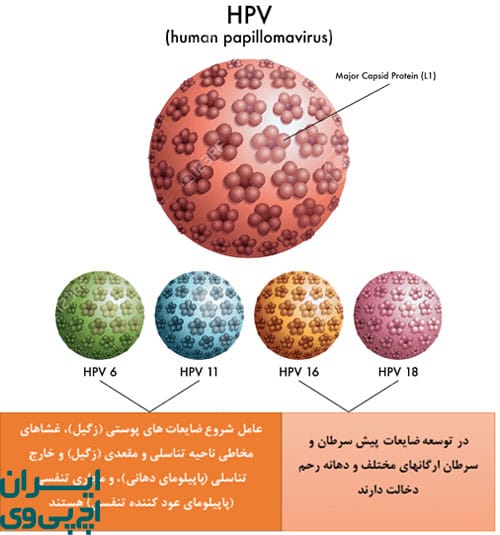 تفاوت در علائم و نشانه‌ها HPV کم‌ خطر و پر خطر