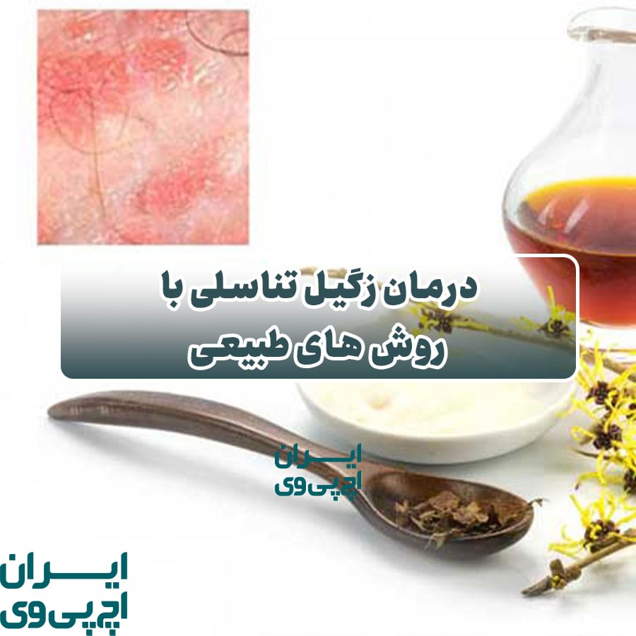 درمان زگیل تناسلی با روش‌ های طبیعی