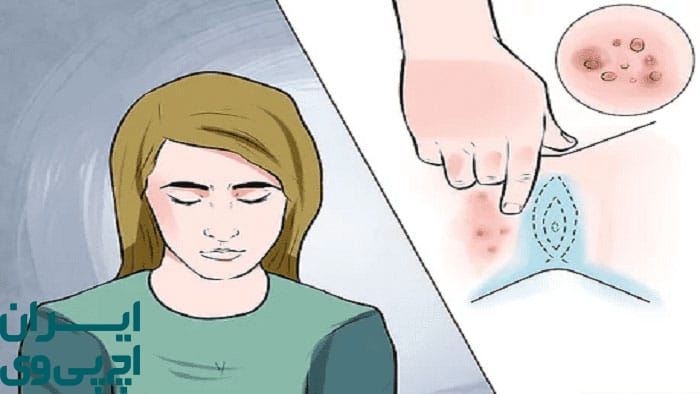 درمان‌ های خانگی HPV بدون مشورت پزشکی