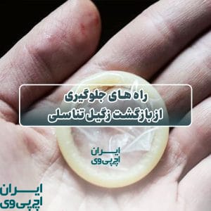 راه های جلوگیری از بازگشت زگیل تناسلی