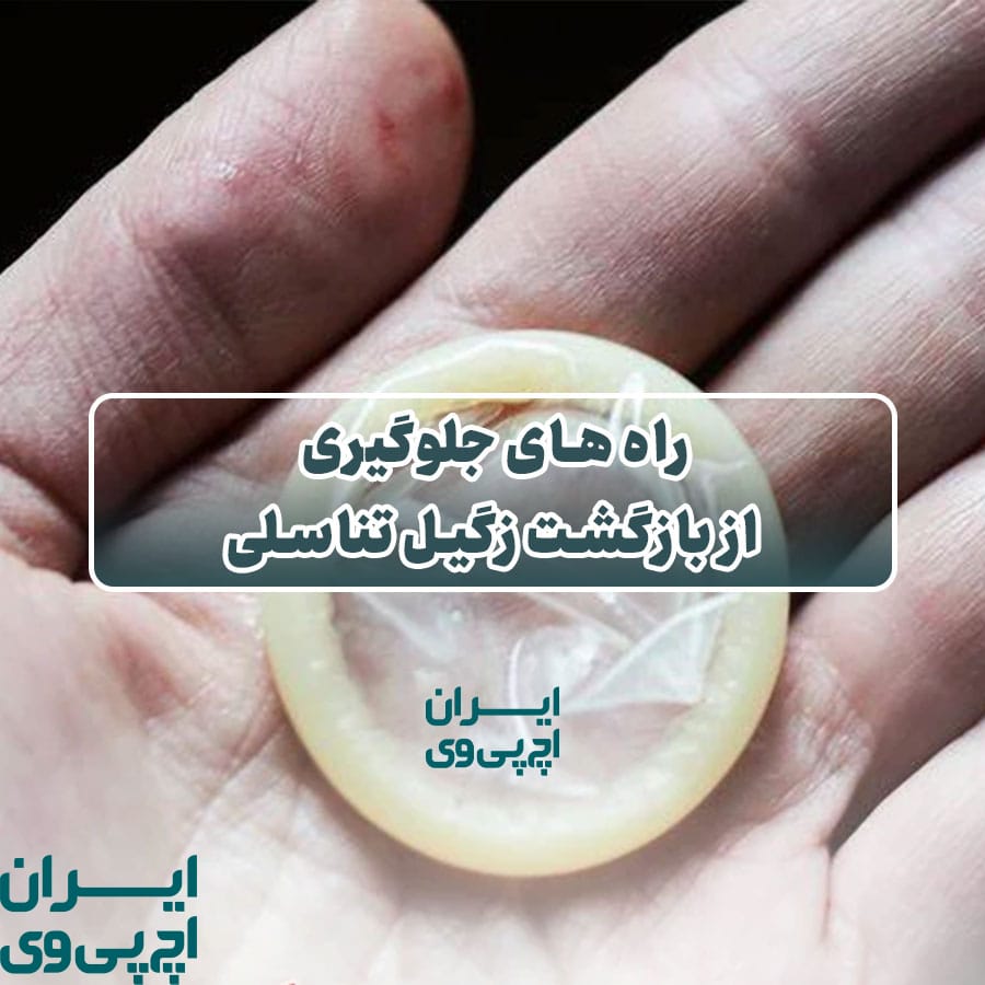راه های جلوگیری از بازگشت زگیل تناسلی