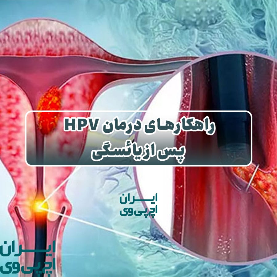 راهکارهای درمان HPV پس از یائسگی