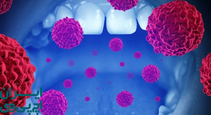 راه‌ های انتقال HPV به ناحیه دهان و گلو