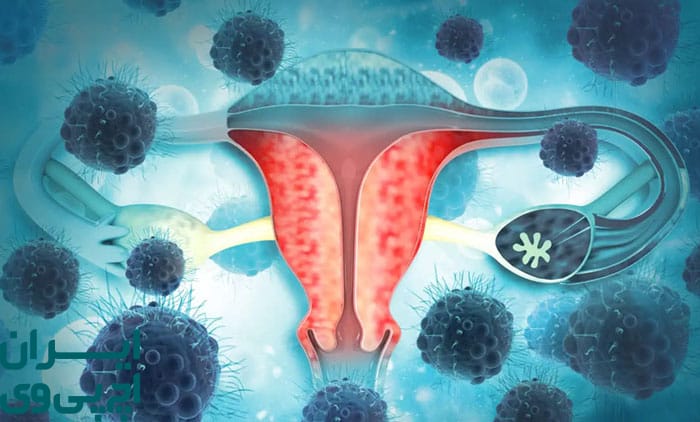رفتار جنسی ایمن و نقش آن در کنترل انتقال HPV