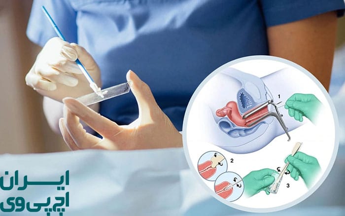 پایش منظم پزشکی و واکسیناسیون تکمیلی HPV