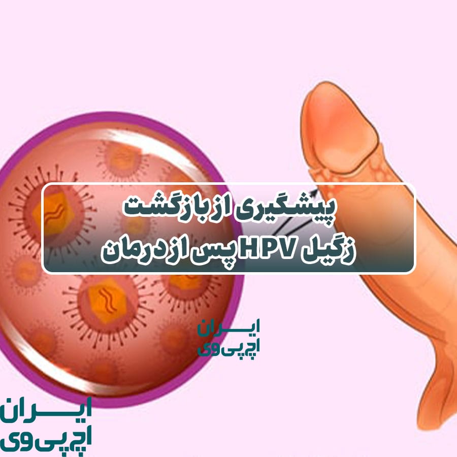 پیشگیری از بازگشت زگیل HPV پس از درمان