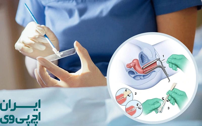 چکاپ‌ های منظم در دوران درمان HPV