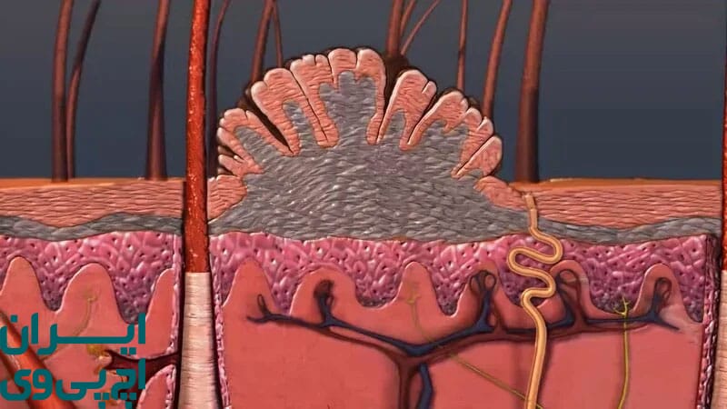 آیا HPV از طریق خودارضایی منتقل می‌شود؟