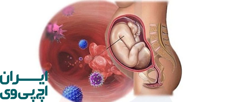 آیا HPV می‌تواند مستقیماً به جنین آسیب بزند؟