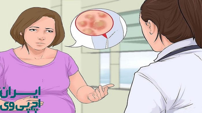 انتقال HPV هنگام زایمان طبیعی