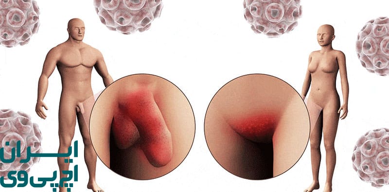 اهمیت معاینه پزشکی و تست‌ های تشخیصی HPV