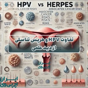 تفاوت HPV و هرپس تناسلی از دید علمی