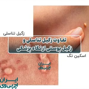 تفاوت زگیل تناسلی و زگیل پوستی از نگاه پزشکی