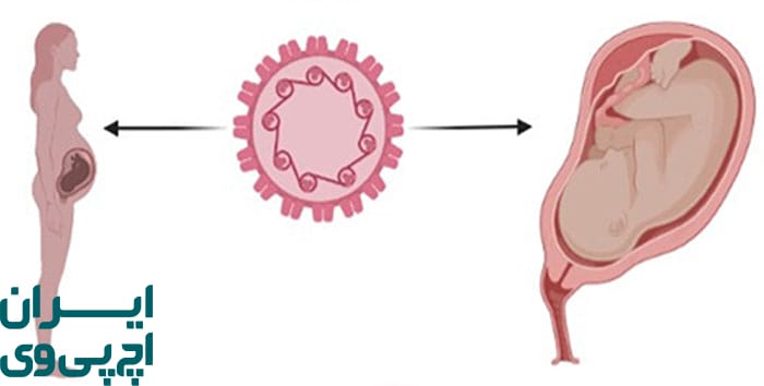 خطر انتقال HPV به نوزاد