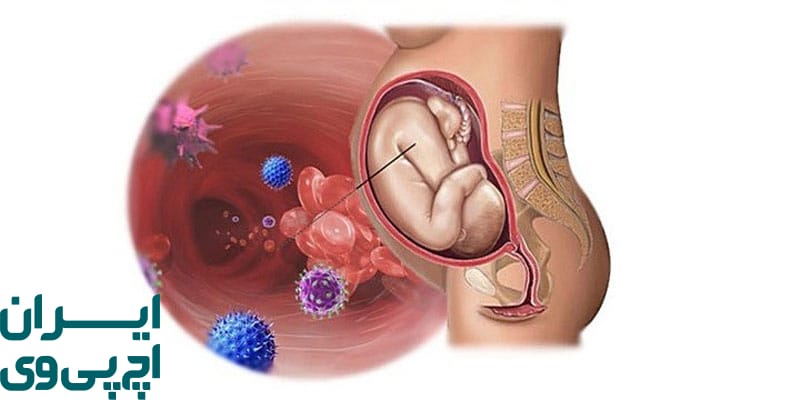 خطرات بالقوه HPV برای نوزادان