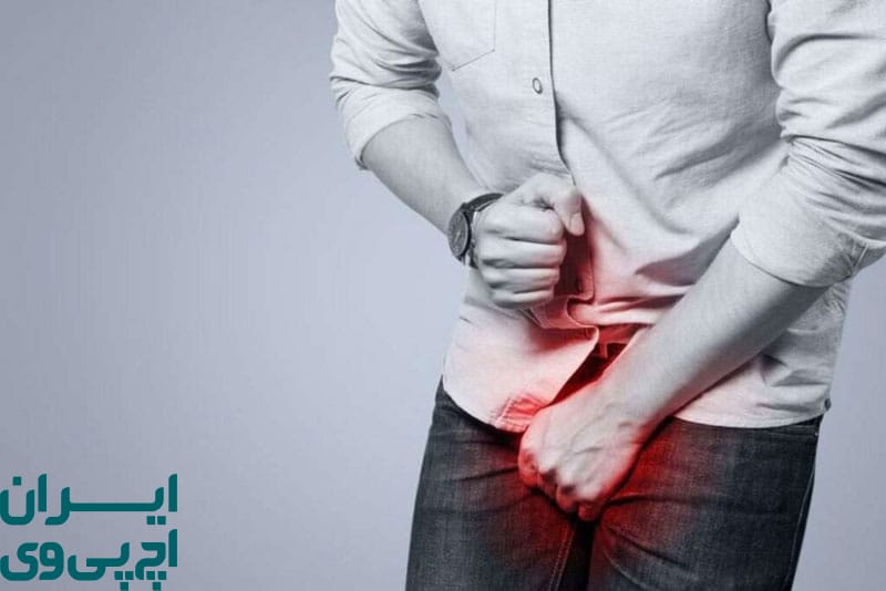 ساختار پوست آلت مردان و تأثیر آن بر پایداری ویروس HPV