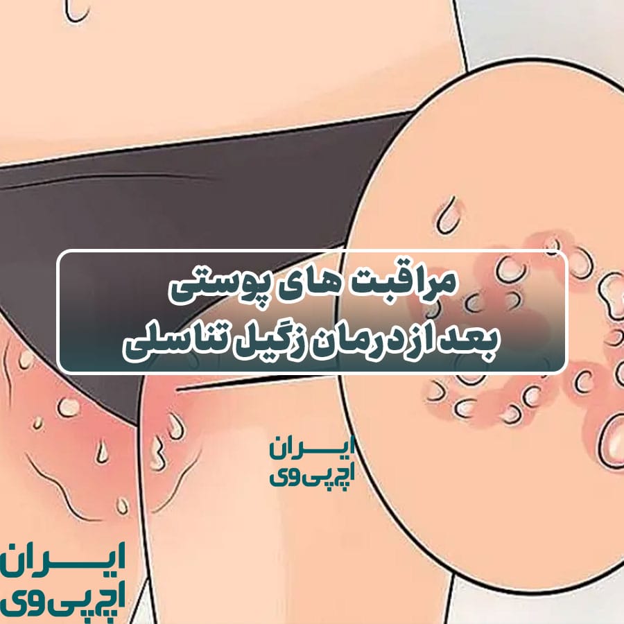 مراقبت‌ های پوستی بعد از درمان زگیل تناسلی