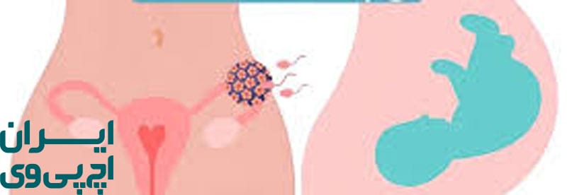 نقش زمان تشخیص HPV در نوع زایمان