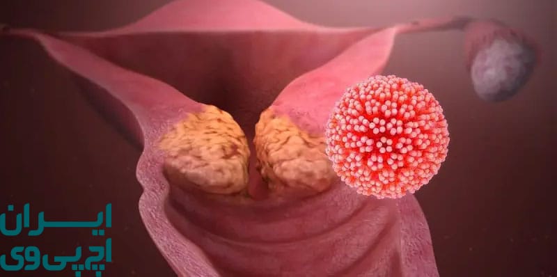 نقش سیستم ایمنی در خاموش ماندن HPV